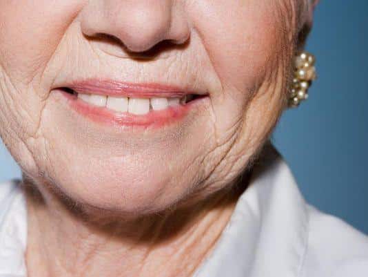 تحلیل رفتن کلاژن پوست صورت و ایجاد چروک در آن