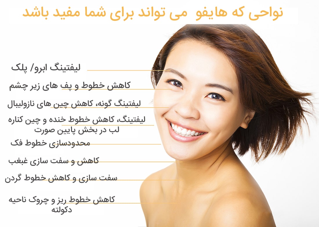 نواحی استفاده هایفو