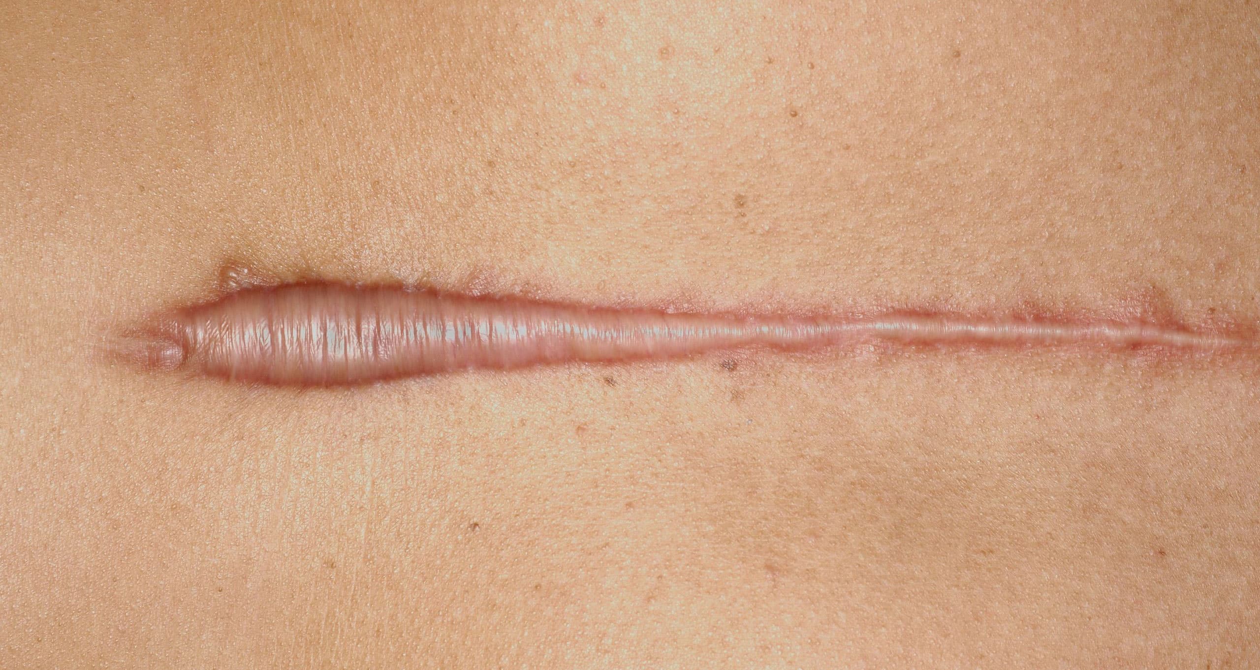 نمونه کلویید