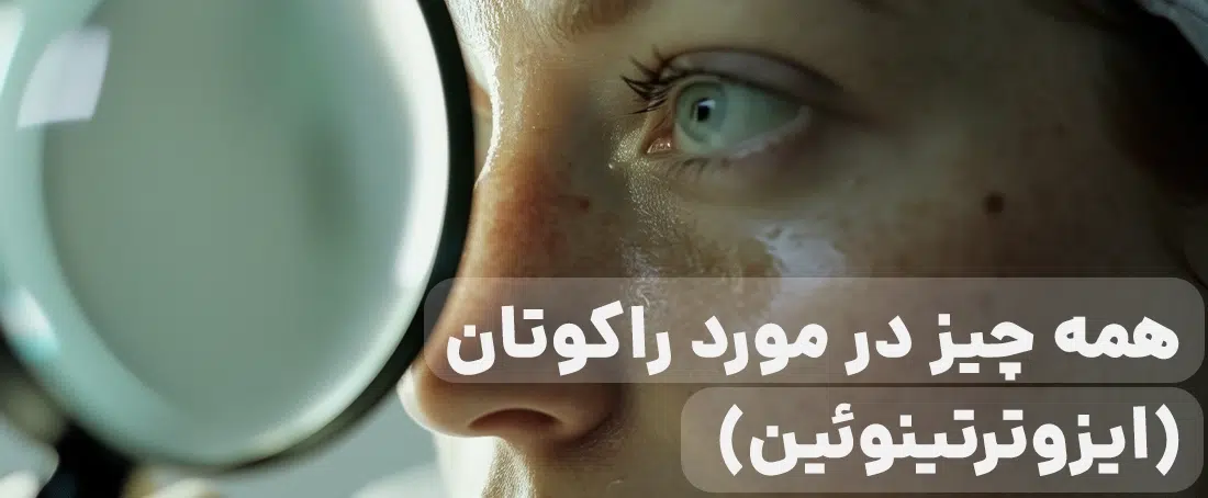 راکوتان